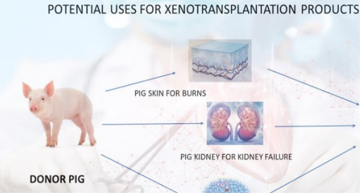 Xenotransplantation